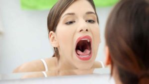 El flemón dental puede durar de dos a tres días
