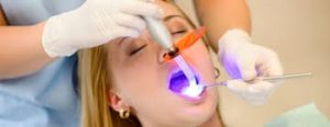  Procedimiento para un empaste dental